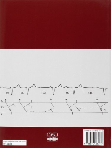I Disordini Del Ritmo Cardiaco. Diagnosi Delle Aritmie Cardiache All'elettrocardiogramma Di Superficie - 2