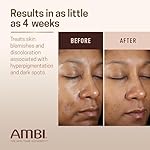 Ambi Even & Clear Advanced Fade Cream, Hydroquinone-free, Hyperpigmentation Treatment, Stubborn Dark Spot Corrector, Results In As Little As 2-3 Weeks, Niacinamide, Licorice Root Extract, PHA, 1 Fl Oz - Image 4