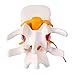 Human Anatomical Lumbar Disc Herniation Model - Lumbar Spine Model for Teaching & Learning - Excellent Way for Demonstrating Disc (White)