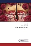 Hair Transplant