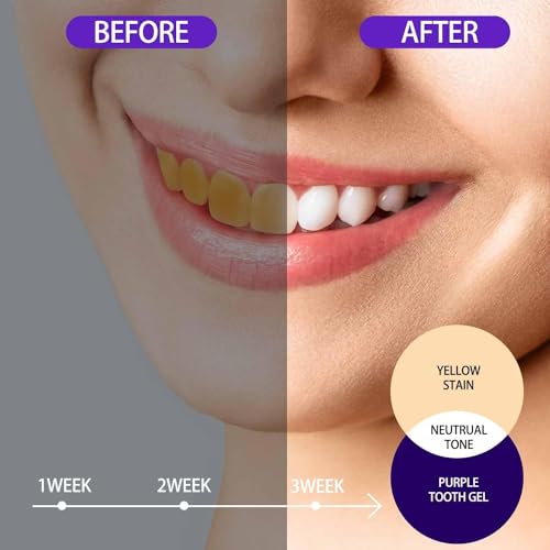 Higiene Bucal Y Dental, Drugstore tiras blanqueadoras Marca LONEOURS (3)