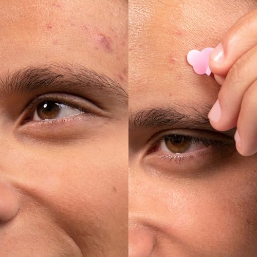 Merci Handy - Patchs Boutons - Traitement Naturel Anti-Bouton et Acné - 24 Patchs x 3 - Pour Adolescents - Soin de Nuit - Réduit les Imperfections Rapidement - Patchs Personnalisables – vue 4