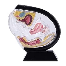 Uterus Model Female Transparent Uterine Anatomy Model Pelvic Cavity Rectum Teaching Model for Medical Educational Training Black