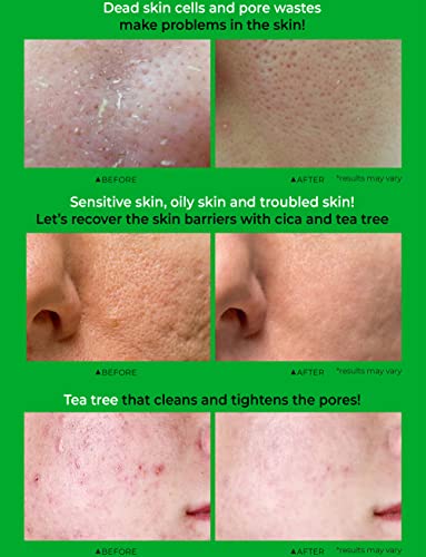 [Dd’ell] Toner Pad | Aha Bha Pha | Exfoliating Cica 20,000Ppm+ Tamanu 20,000Ppm Peeling & Pore-Tightening & Deep Hydrating Skin Extract 5.07 Fl. Oz. | Cruelty-Free, Alcohol-Free, Paraben-Free #TOP5