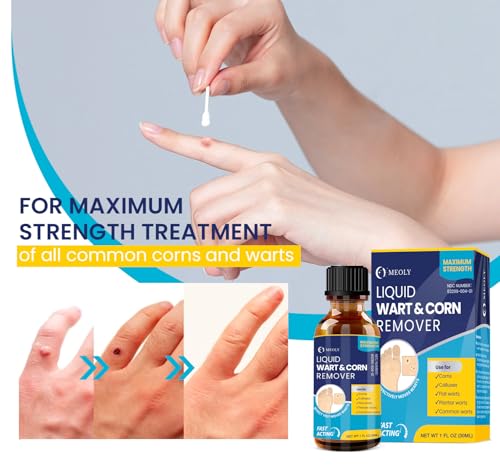 salicylic wart removal freeze away fast-acting wart removal maximum strength for men and women - plantar wart genital wart corns calluses 30 ml