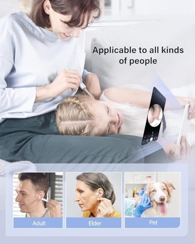 Image of AIXMEET Earocam Earwax Removal Tool Kit with HD Camera WiFi Connection & 6 LED Lights Endoscope Tool Ear Cleaner Tool Set of 8, Otoscope with Light for iOS & Android Kids Children Adults Gift Gadget