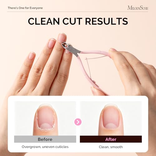 Image of Melodysusie Cuticle Trimmer, Stainless Steel Cuticle Nipper Cuticle Remover with Double Spring and Ergonomic Handle, Pedicure Manicure Tools for Home Salon