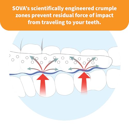 Image of SOVA Junior Night Guard, Snow White - 1.6mm Thin - Custom-Molded Fit - Protects Against Nighttime Teeth Grinding & Clenching - Odor & Taste Free - Remoldable Up to 20 Times - Non Toxic
