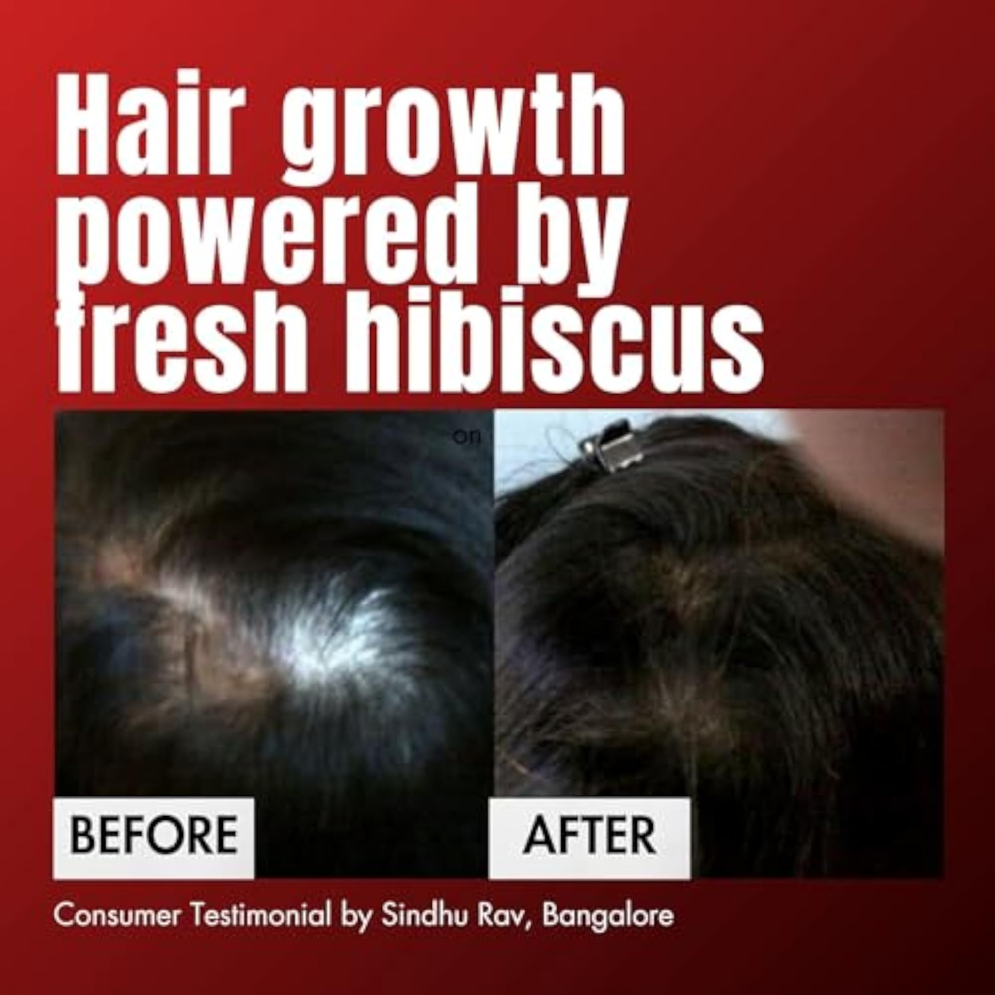 HM Love Scalp & Hair Oil | Promotes Hair Growth