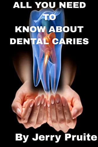 All you need to know about dental caries