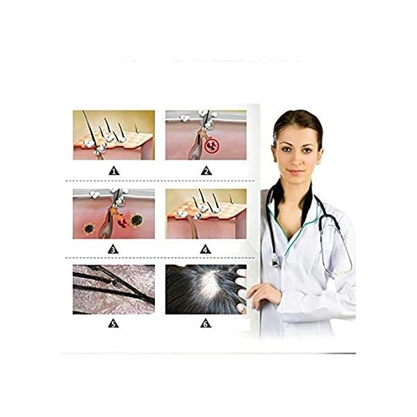 Ginger-Germinal-Oil-Ginger-Hair-Growth-Serum-Ginger-Essential-Oil-Stop-Hair-Loss-Hair-Thinning-Treatment-Hair-Growth-Oil-for-Women-Men-30ML-3-Pack Ginger Germinal Oil, Ginger Hair Growth Serum, Ginger Essential Oil Stop Hair Loss Hair, Thinning Treatment Hair Growth…