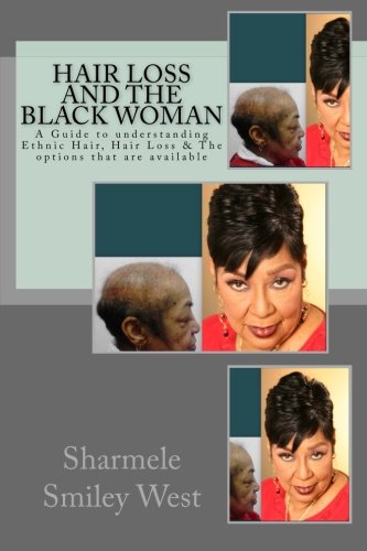Hair Loss and the Black Woman: A Guide to understanding Ethnic Hair, Hair Loss & The options that are available Hair Loss and the Black Woman: A Guide to understanding Ethnic Hair, Hair Loss & The options that are available