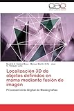 Localización 3D de objetos definidos en mama mediante fusión de imagen: Procesamiento Digital de Mastografías
