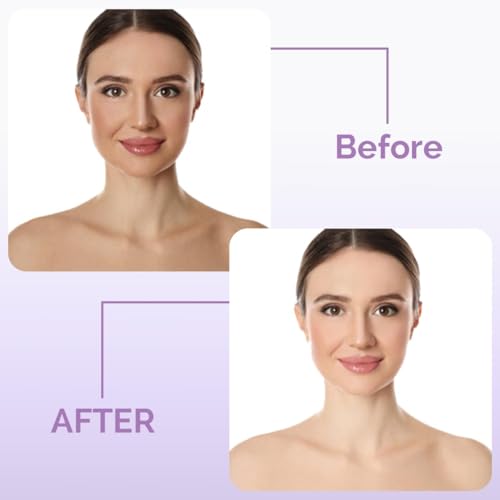 Image of Ayumcure Glutathione & Niacinamide Skin Whitening Cream 50 g | Kojic Acid, Vitamin C & E | Anti-Aging, Tan Removal, Brightening Cream for Women & Men | All Skin Types