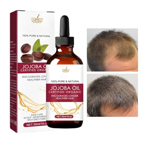 Aceite de crecimiento del cabello: aceite para el cabello natural para mujeres y hombres, aceite de cabello disperso | Nurishing Jojoba Oil, aceite de densidad capilar anti-frytis