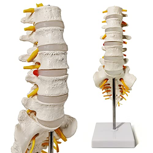 Image of EVOTECH SCIENTIFIC Lumbar Spine Anatomy Model with Sacrum and Spinal Nerves, Didactic Replica of Lumbosacral Section with Nerves and A Herniated Disc At L4, Includes Base for Medical Teaching Display