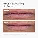 The Ordinary PHA 5% Exfoliating Lip Serum, Hydrating Overnight Lip Exfoliator Treatment, 0.5 Fl Oz
