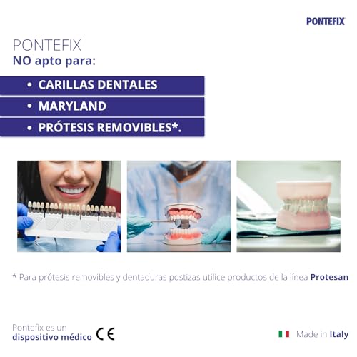Pontefix Dentalzahnzement - Befestigt Brücken, Kronen und Stiftzähne, Selber Machen