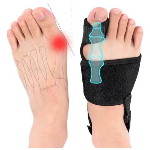 MUSIBEAUTY Bunion Corrector Splint for Women & Men - Orthopedic Big Toe Straightener for Hallux Valgus, Non-Surgical Relief, Day & Night Support - 2 Pack Cover