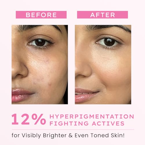 Image of Hyphen Advanced De-Pigmentation Serum For Hyperpigmentation, Melasma, Dark Spots & Scars With 2% Kojic Acid | Visibly Brightens & Even Tones Skin | Serum For Women & Men - 30ml
