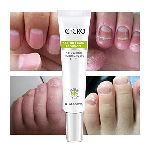 3 Pcs Efero Nail Treatment Repair Gel,Nail Repair Cream,Toe Be Health Instant Beauty Gel For Nail Growth Care,Restores Appearance Of Discolored Or Damaged Nails #TOP5
