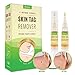 ULensy 2 PCS Skin Tag Remover, Effectively Remove Skin Tag with Advanced Formula, 10 ML