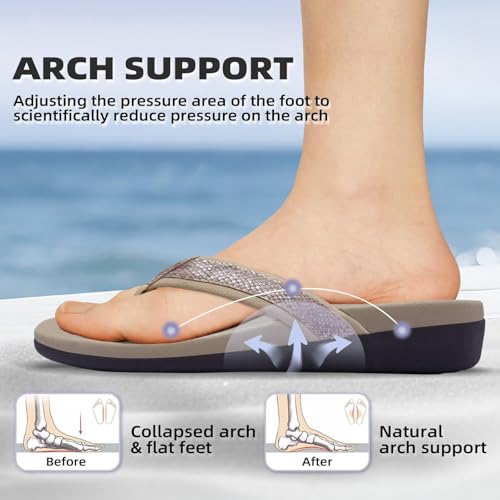 Image of MEGNYA Womens Orthotic Flip Flops, Plantar Fasciitis Sandals for Flat Feet with Arch Support Thong Style Flip Flops, Comfortable Walking Sandals for Beach, Vacation