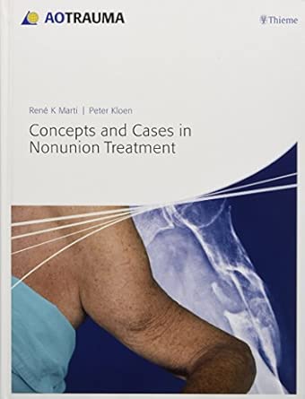 Concepts and Cases in Nonunion Treatment book cover