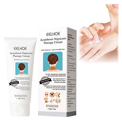 Nigrifree Acanthosis Nigricans Therapy Cream, Dark Spot Corrector Cream Retinol Creme, Nigrifix Creme Mit Milchsäure Cover