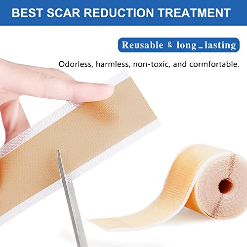 ZODENIS Silicone Scar Tape Roll, Silicone Scar Sheets, Scar Silicone Strips (1.6” x120”Inch - 3M), Easy-Tear Gel Tape For Scar, Soft Silicone Scar for Surgery Scars, Medical Grade Wound Dressing - Thumbnail 6