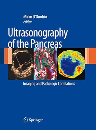 Ultrasonography of the Pancreas: Imaging and Pathologic Correlations 2012th Edition book cover