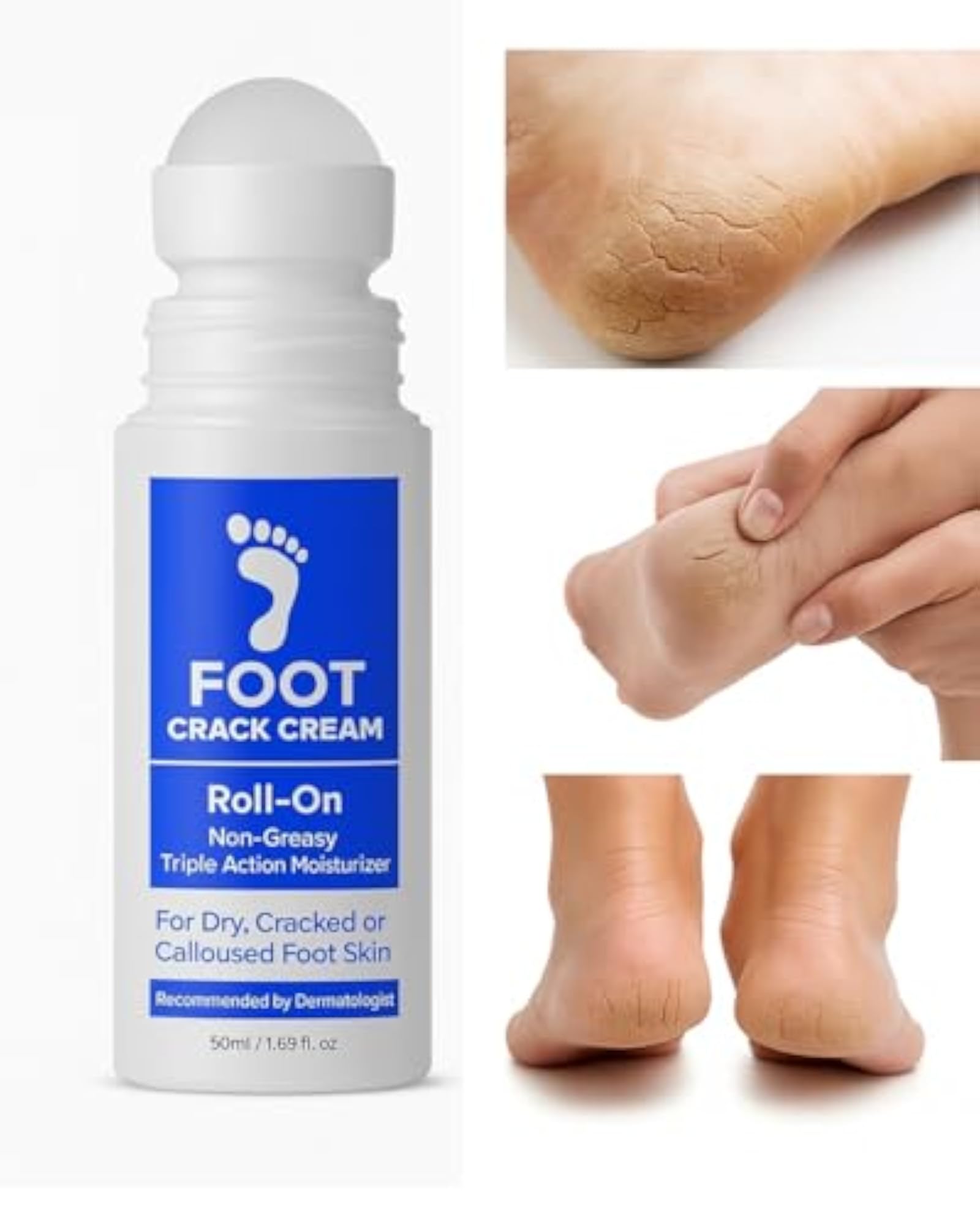 20% Urea Crack Heel Repair Foot Cream Roll On