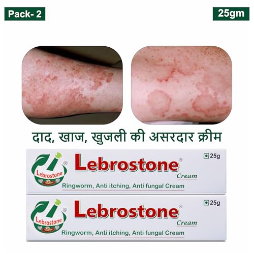 Image of Cream Ayurvedic Treatment for Ringworm, Anti Itching, & Anti Fungal Infections (25 (Gram) Pack of 2, 50, gram)