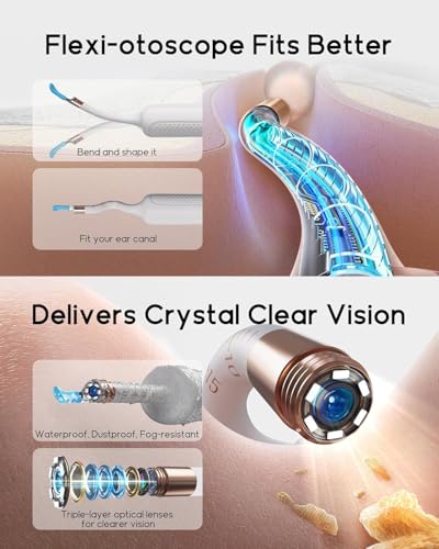 Image of Bebird Earsight Plus R37R Ear Wax Removal Tool Camera, FSA HSA Eligible Items, Smart Ear Cleaner with Painless Visual Tweezers, Flexible Ear Camera Otoscope, Home ENT Cleaning Kit for Family,White