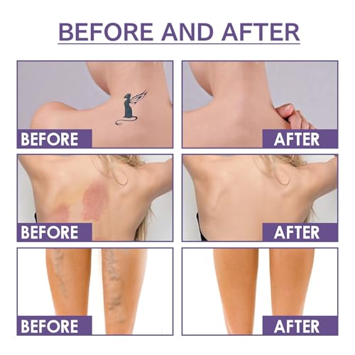 All Over Complexion Perfector, Body Coverage Perfector, Tattoo Abdeckung, Tattoo Cover Up Makeup, Bein Make Up Wasserfest, Zum Abdecken von Tätowierungen Narben Allen Defekten