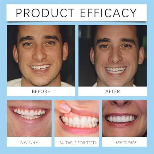 image for ERISAMO Silicone Reline Denture Set, Silicone Reline Denture Set, Soft