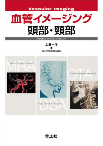 無料電子書籍 アプリ 血管イメージング頭部・頸部 バイ