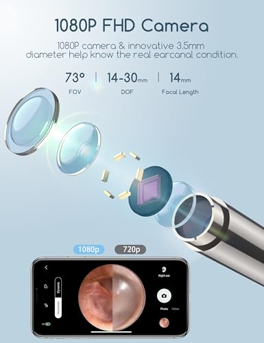 Ohrenschmalz Entferner Otoskop, Qimic WiFi Ohrreiniger, 1080P Ultradünne HD Drahtlos Wasserdicht Ohrenspiegel mit 3.5mm Linse und 6 LEDs für iPhone, iPad und Android-Smartphones
