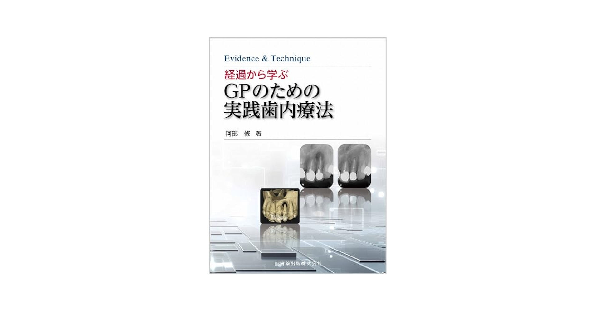 経過から学ぶGPのための実践歯内療法※裁断済み Evidence & Technique 経過から学ぶGPのための実践歯内療法
