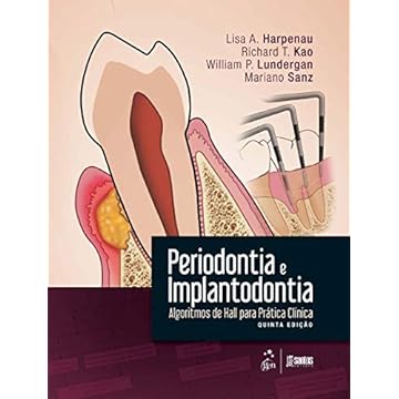 Capa do livro Periodontia e Implantodontia - Algoritmos de Hall para Prática Clínica