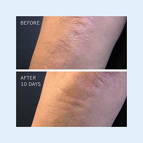 First Aid Beauty KP Bump Eraser Body Scrub with 10% AHA: Vegan Body Scrub to Decongestant Pores and Gently Exfoliate the Skin (8 oz)