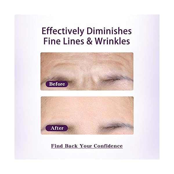 Beauty Pear Forehead Anti-Wrinkle Cream, Facial Wrinkle Removal Cream Reduce Furrows, Expression Lines and Frown Lines