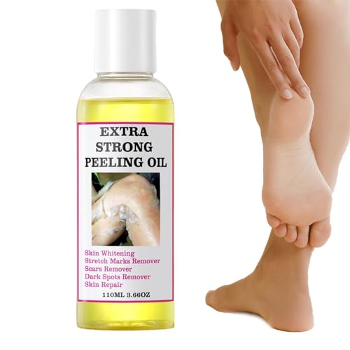 Shannan Peeling Oil For Dark Skin, 110ml Portable Body Exfoliate, Whitening Softening Callus Removal, Unisex