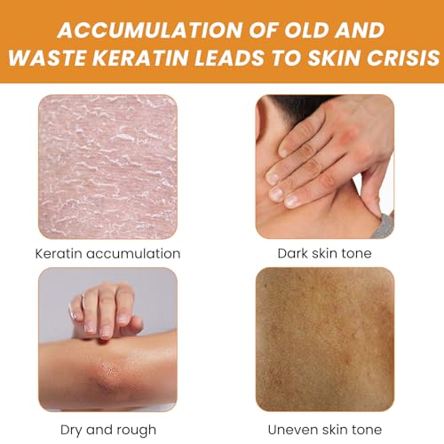 Orange Face Scrub Exfoliator,Acne Exfoliating Face Scrub,Pore Facial Scrub,Remove Blackhead & Smooth Skin Tone,Face Scrub for Men & Women,Vitamin C Body Scrub for Dull Skin,Arm & Back & Leg-50g - Image 7