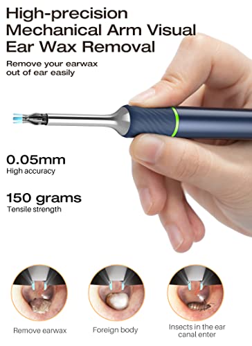 Ear Camera,Ear Wax Removal Tool,Bebird Ear Cleaner Tweezers,10 Megapixels Ear Camera,Gimbaled Gyroscope, 6 Earwax Removal Kit,12 Ear Spoon,Base Storage,Ear Cleaning Kit For Iphone, Android #TOP4