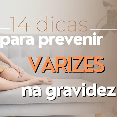 Gr&aacute;vida: VARIZES | 14 DICAS para PREVENIR e EVITAR na GRAVIDEZ - Ludmilla Hirata