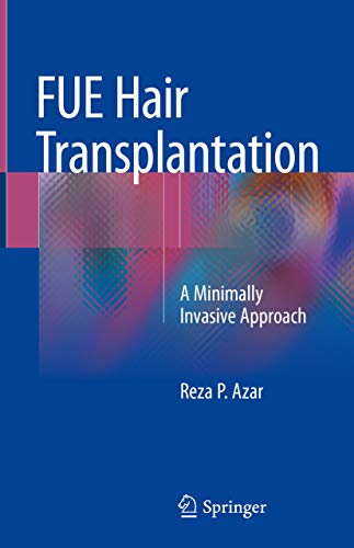 FUE Hair Transplantation: A Minimally Invasive Approach (English Edition)