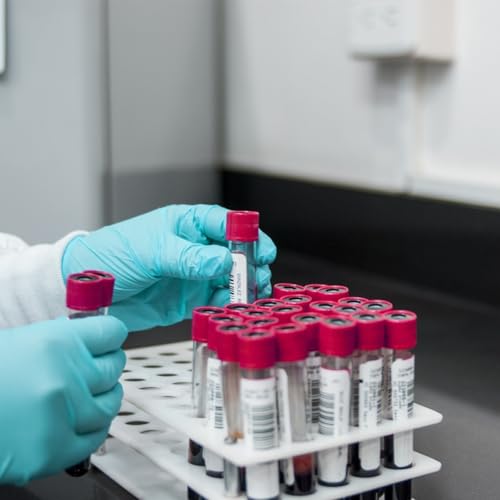 A chat with Prostate Cancer UK: Assistant Director of Health Improvement, Amy Rylance