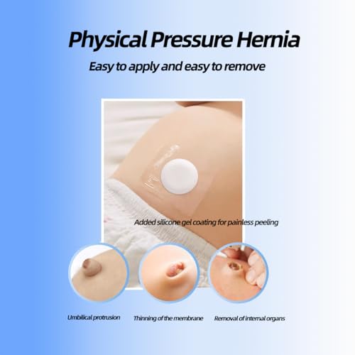 Image of Baby Belly Navel Patches, Cotton Pads for Baby Belly Button Hernia, Infant Essentials Must Haves(1 Set+10 Replacement Stickers)