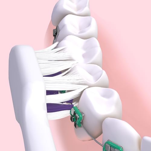 GUM SONIC ORTHO batteriebetriebene elektrische Schallzahnbürste | Für Zahnspangenträger entwickelt | Sanft zu Zähnen und Zahnfleisch | X1 Bürste, X2 Ersatzköpfe, X1 AAA-Batterie, X1 Bonusprobe | Weiß – Bild 3